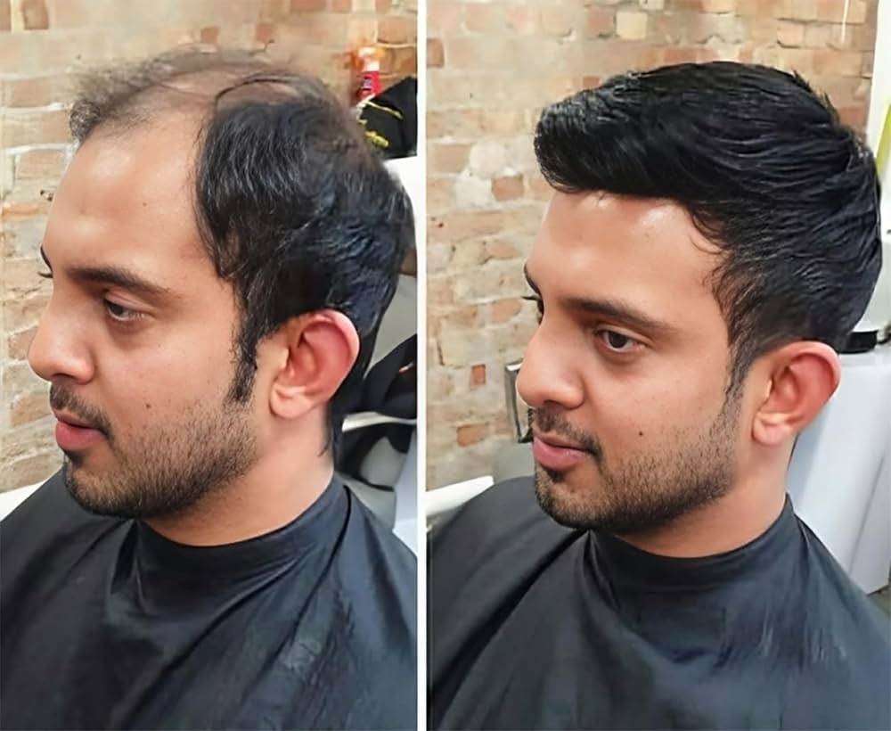Before & After
