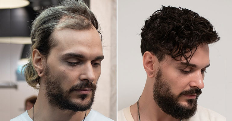Before & After