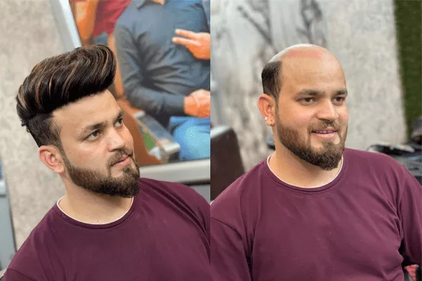 Before & After